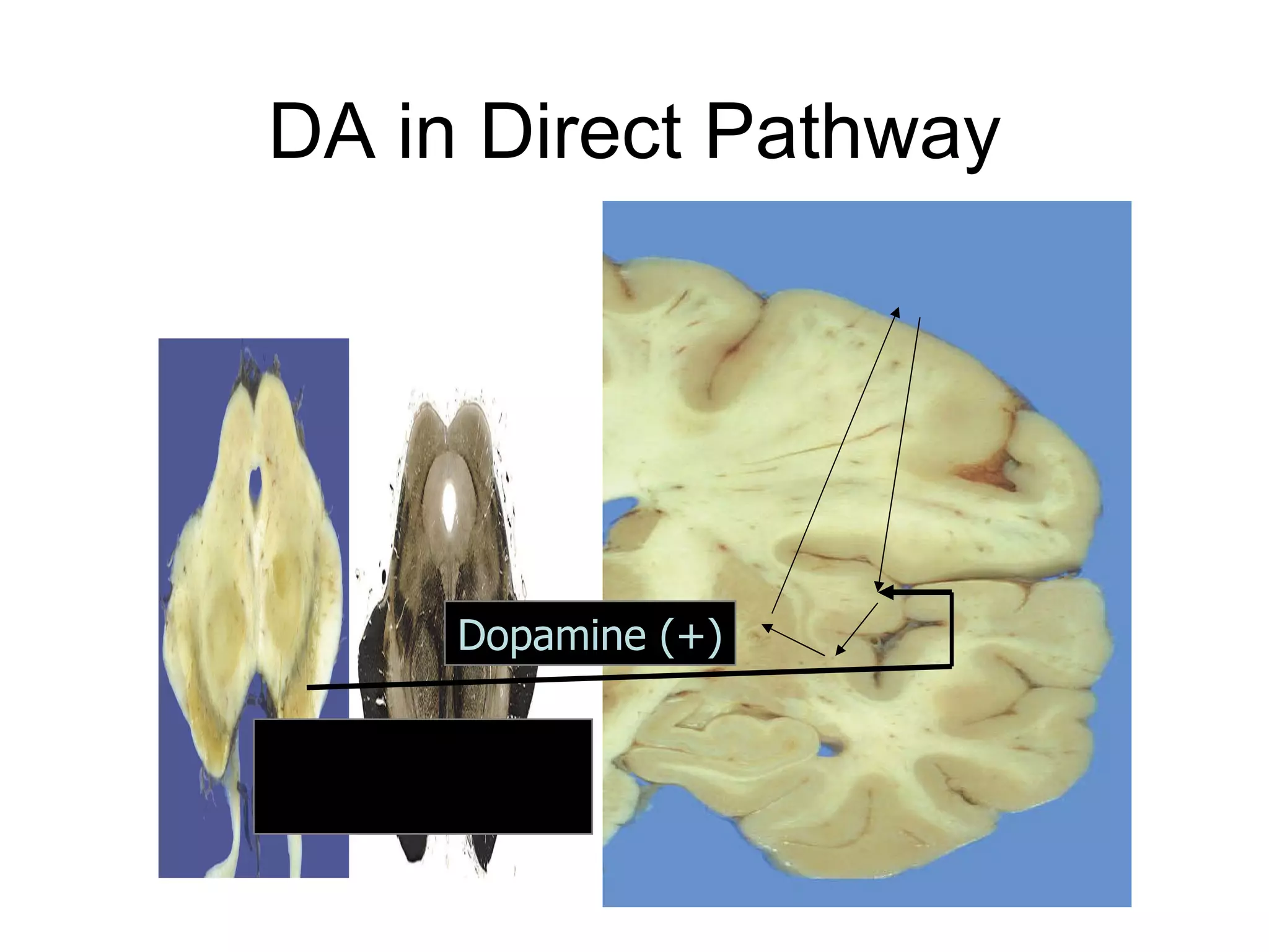DA in Direct Pathway Substantia Nigra pars compacta Dopamine (+) 