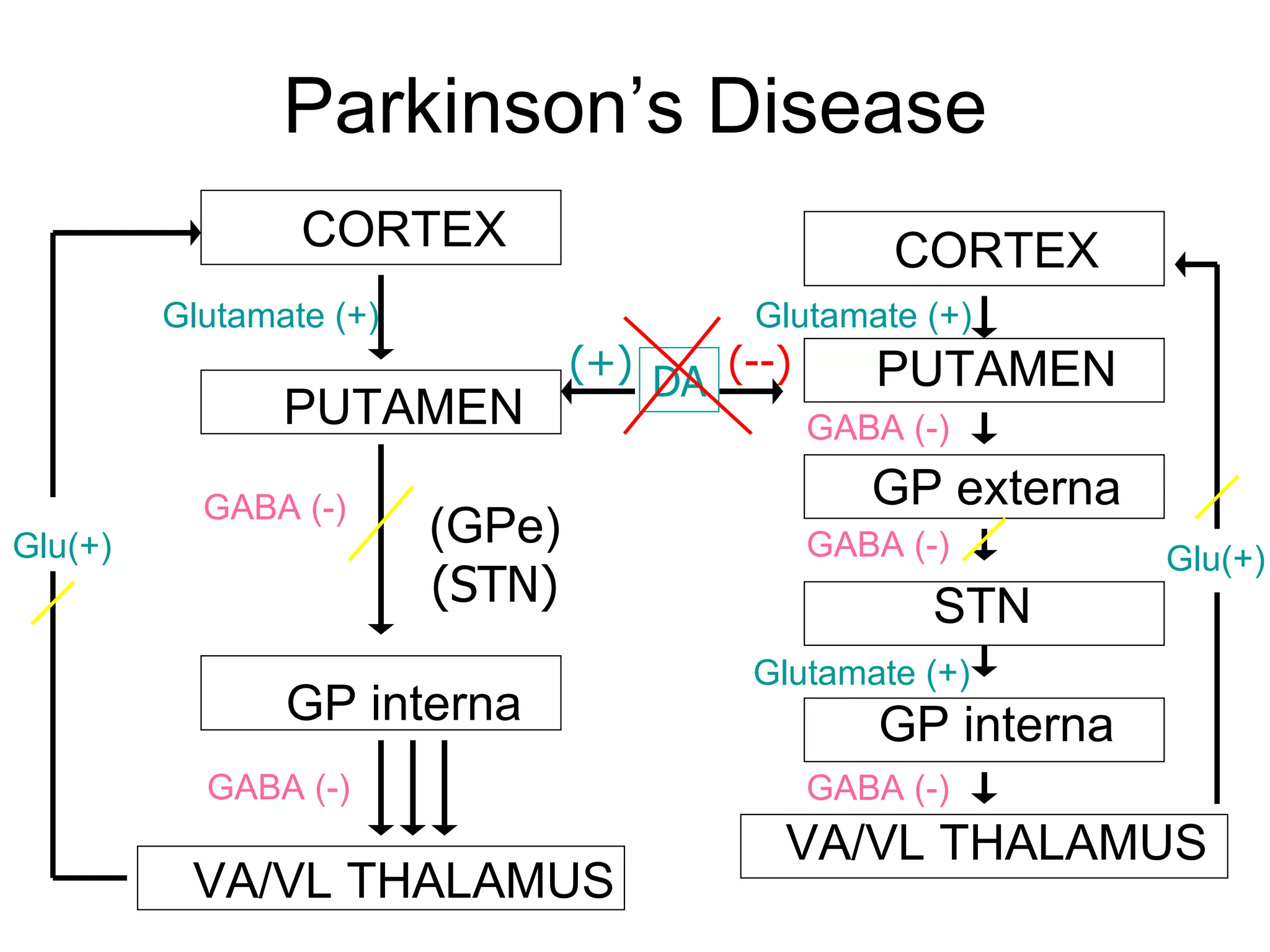 Parkinson’s Disease CORTEX PUTAMEN   (GPe)   (STN) GP interna VA/VL THALAMUS Glutamate (+) Glu(+) GABA (-) GABA (-) (--) CORTEX PUTAMEN GP externa STN GP interna VA/VL THALAMUS Glutamate (+) GABA (-) GABA (-) GABA (-) Glutamate (+) DA (+) Glu(+) 