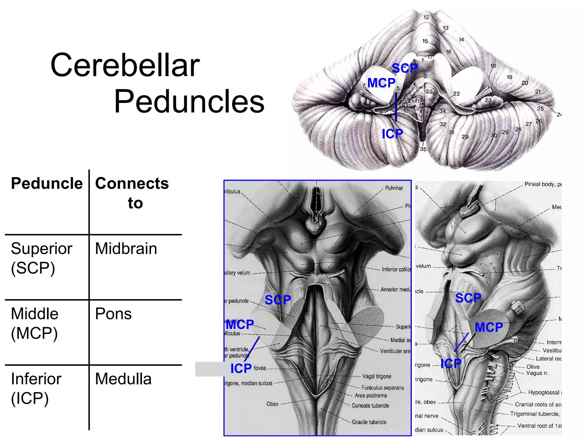 Cerebellar   Peduncles Medulla Inferior (ICP) Pons Middle (MCP) Midbrain Superior (SCP) Connects to Peduncle SCP SCP SCP MCP MCP MCP ICP ICP ICP 