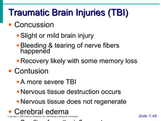 Traumatic Brain Injuries (TBI)Traumatic Brain Injuries (TBI)
Slide 7.49Copyright © 2003 Pearson Education, Inc. publishing as Benjamin Cummings
• Concussion
•Slight or mild brain injury
•Bleeding & tearing of nerve fibers
happened
•Recovery likely with some memory loss
• Contusion
•A more severe TBI
•Nervous tissue destruction occurs
•Nervous tissue does not regenerate
• Cerebral edema
 