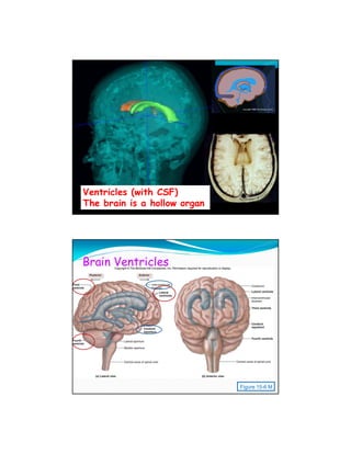 Ventricles (with CSF)
                   Research Martin Styner


The brain is a hollow organ




Brain Ventricles




                                            Figure 15-6 M
 