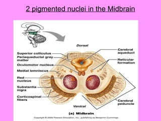 2 pigmented nuclei in the Midbrain 