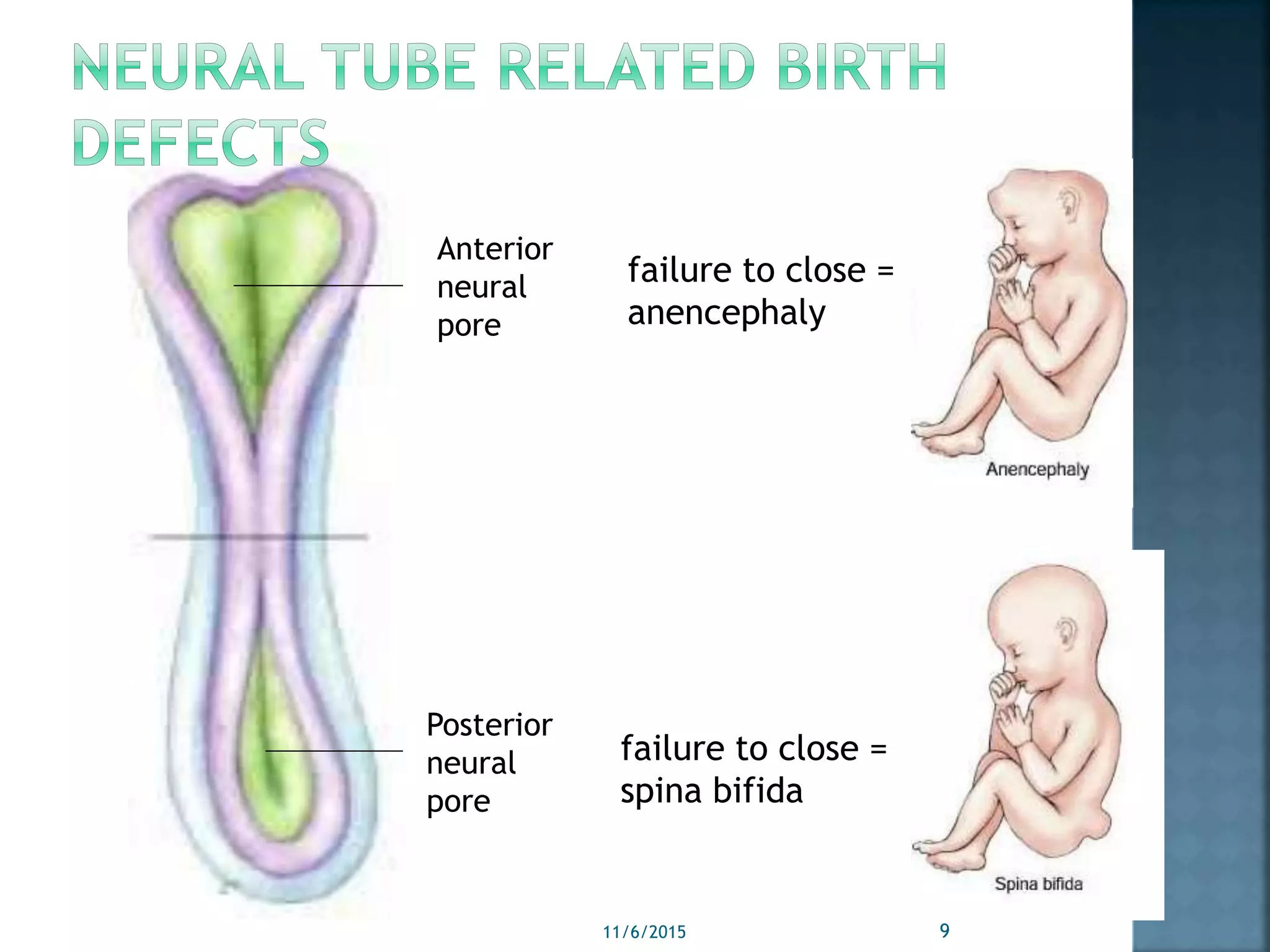 Anterior
neural
pore
Posterior
neural
pore
failure to close =
anencephaly
failure to close =
spina bifida
11/6/2015 9
 