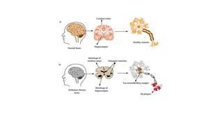 Chapter Over Slide central nervous system disorders pharmacotherapeutics | PPTX