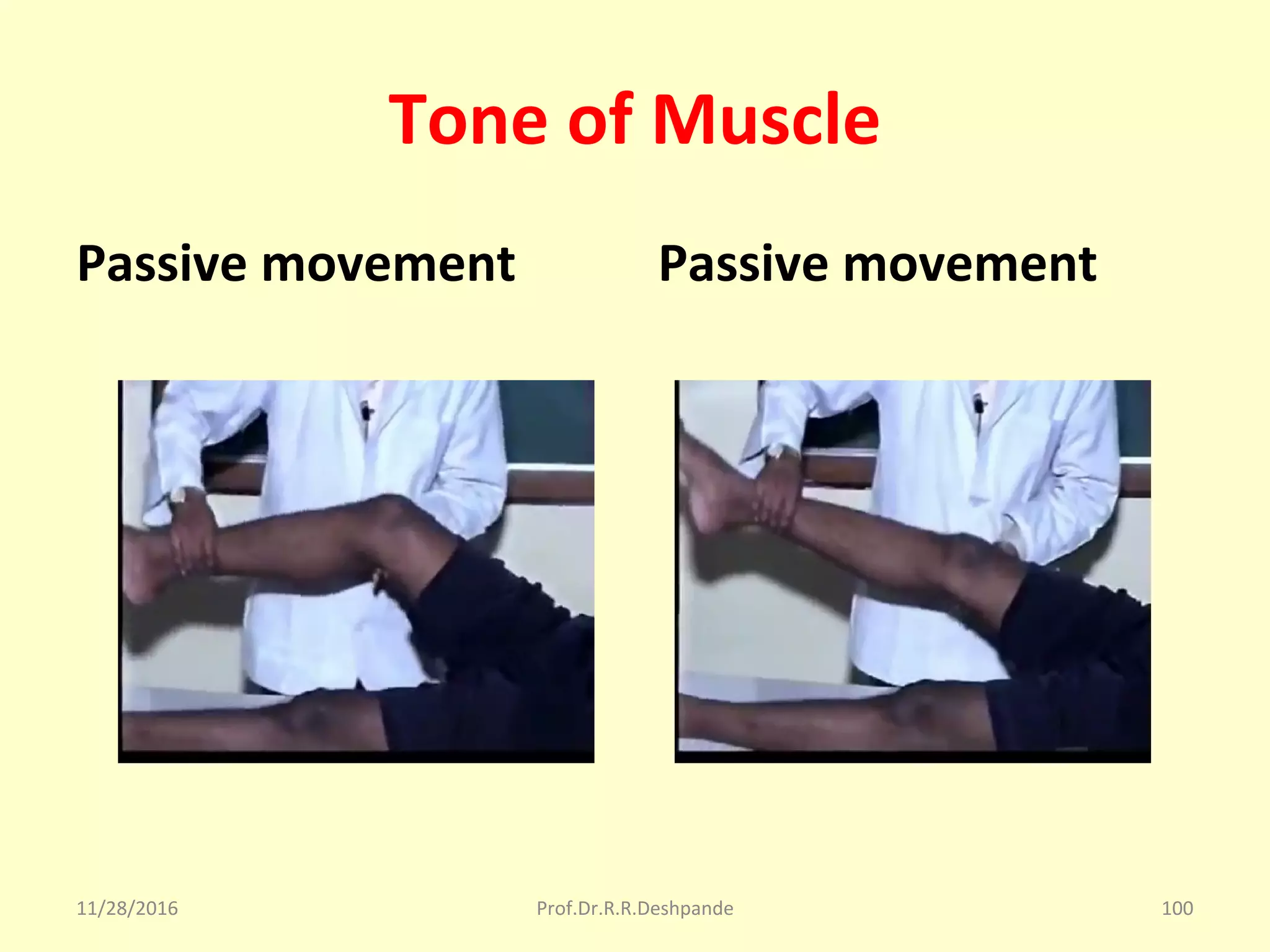 Tone of Muscle
Passive movement Passive movement
11/28/2016 Prof.Dr.R.R.Deshpande 100
 
