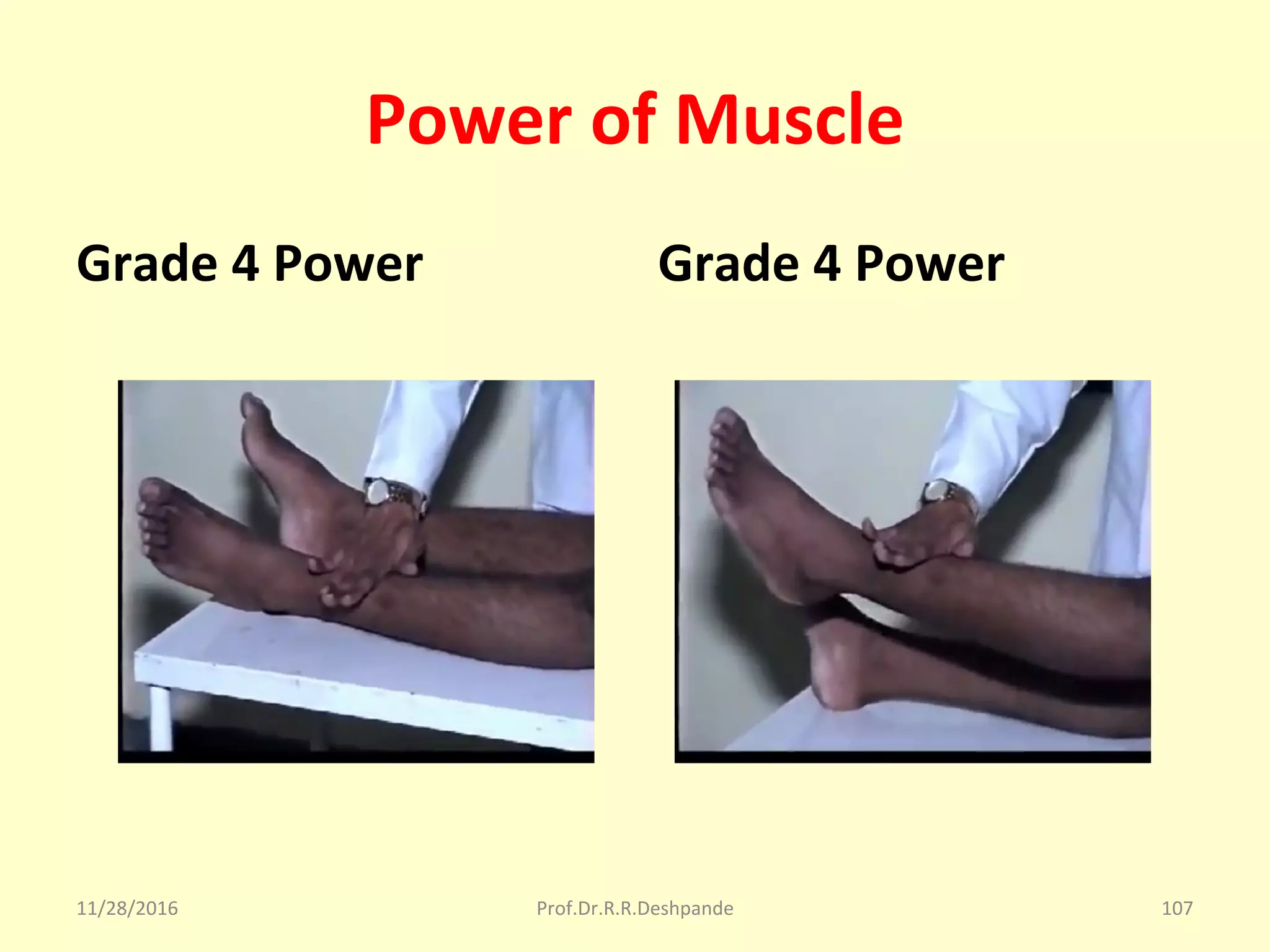 Power of Muscle
Grade 4 Power Grade 4 Power
11/28/2016 Prof.Dr.R.R.Deshpande 107
 