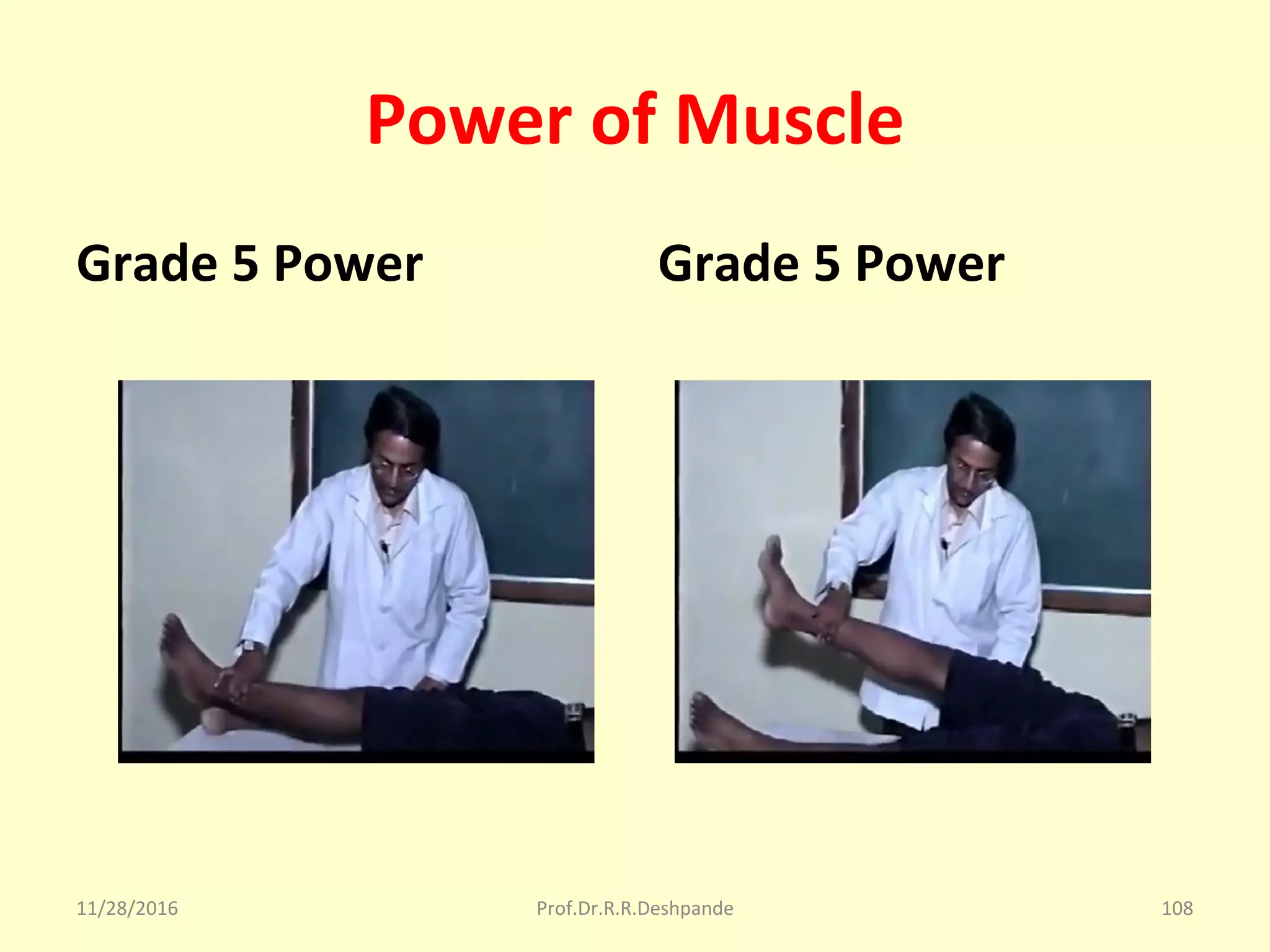 Power of Muscle
Grade 5 Power Grade 5 Power
11/28/2016 Prof.Dr.R.R.Deshpande 108
 