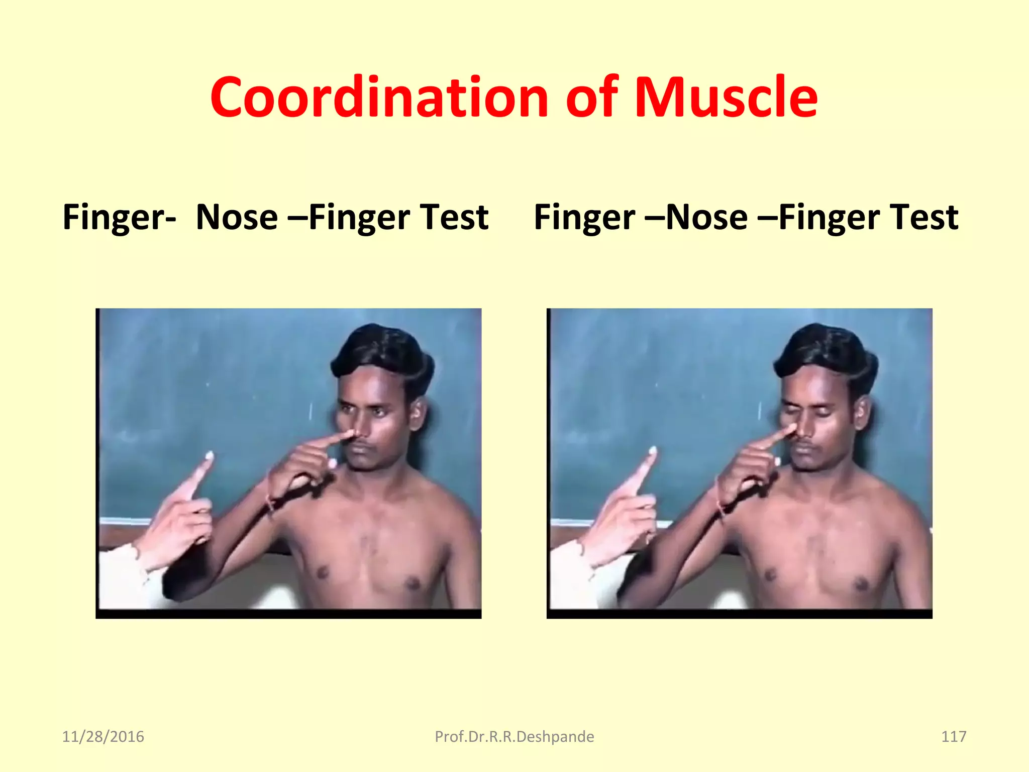 Coordination of Muscle
Finger- Nose –Finger Test Finger –Nose –Finger Test
11/28/2016 Prof.Dr.R.R.Deshpande 117
 