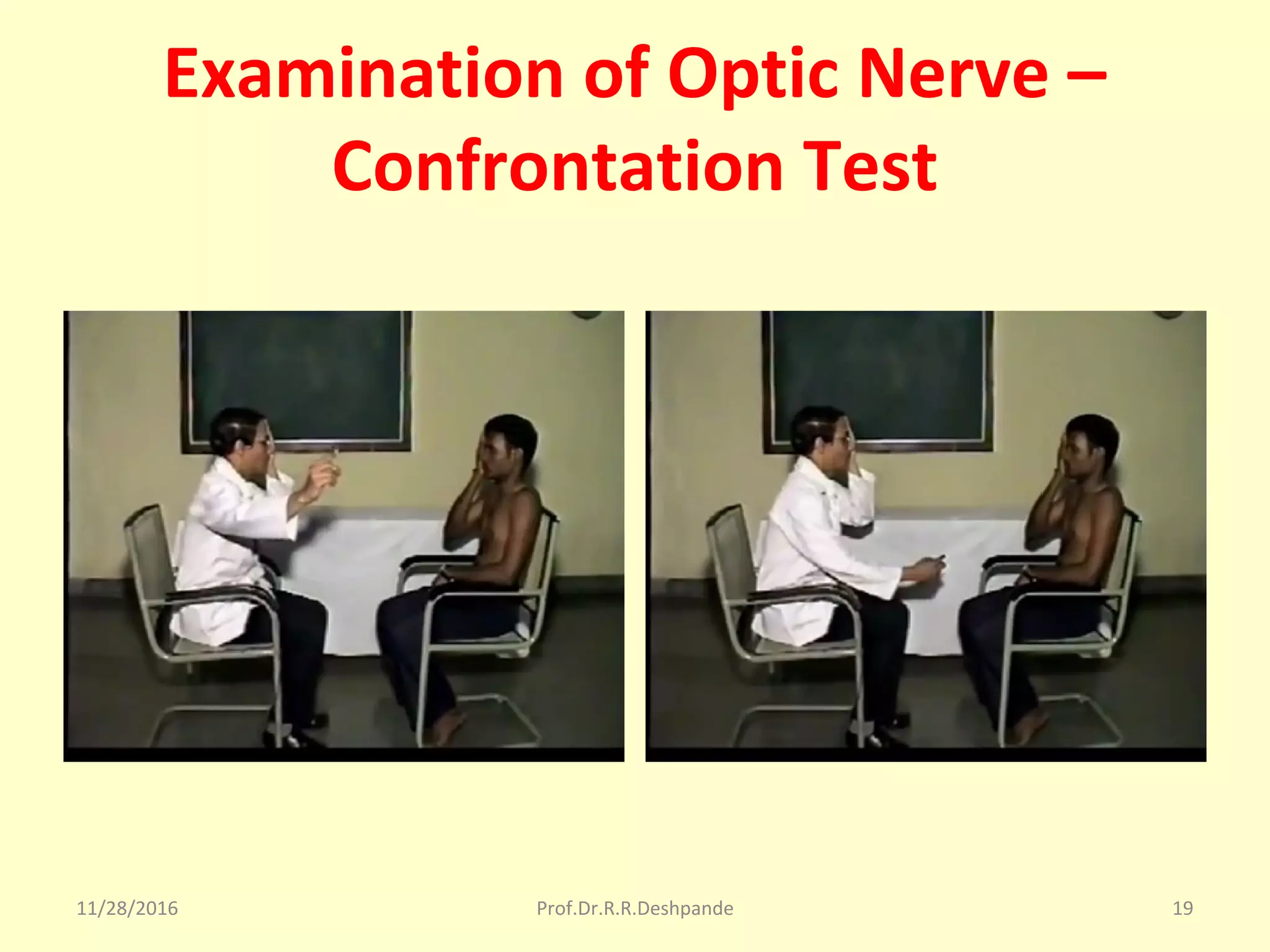 Examination of Optic Nerve –
Confrontation Test
11/28/2016 Prof.Dr.R.R.Deshpande 19
 