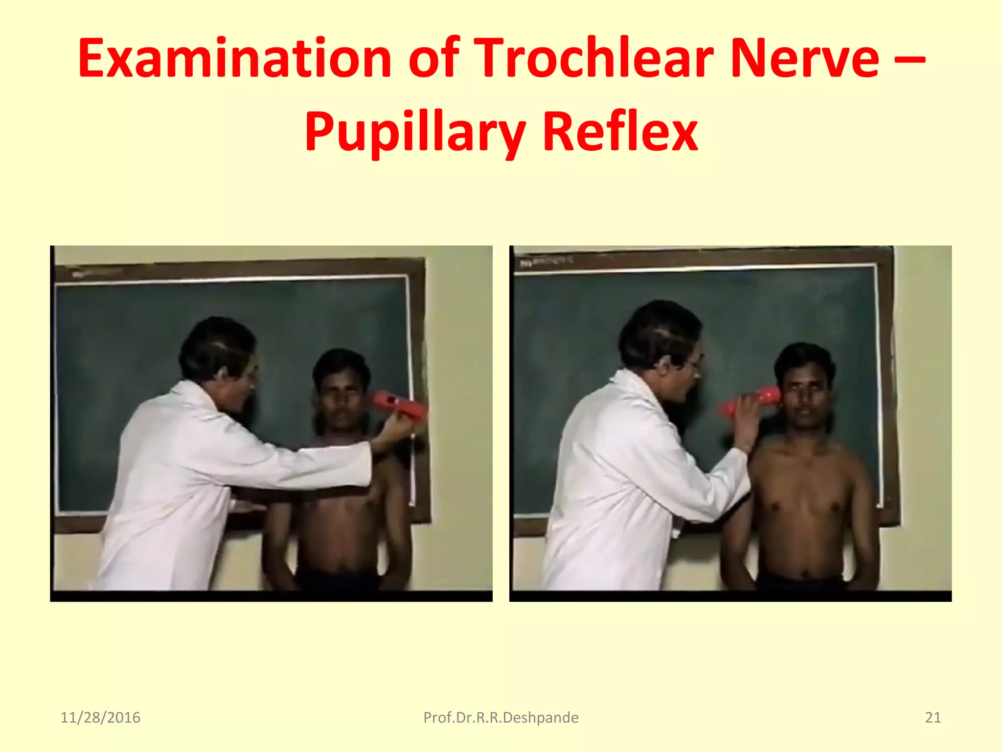 Examination of Trochlear Nerve –
Pupillary Reflex
11/28/2016 Prof.Dr.R.R.Deshpande 21
 