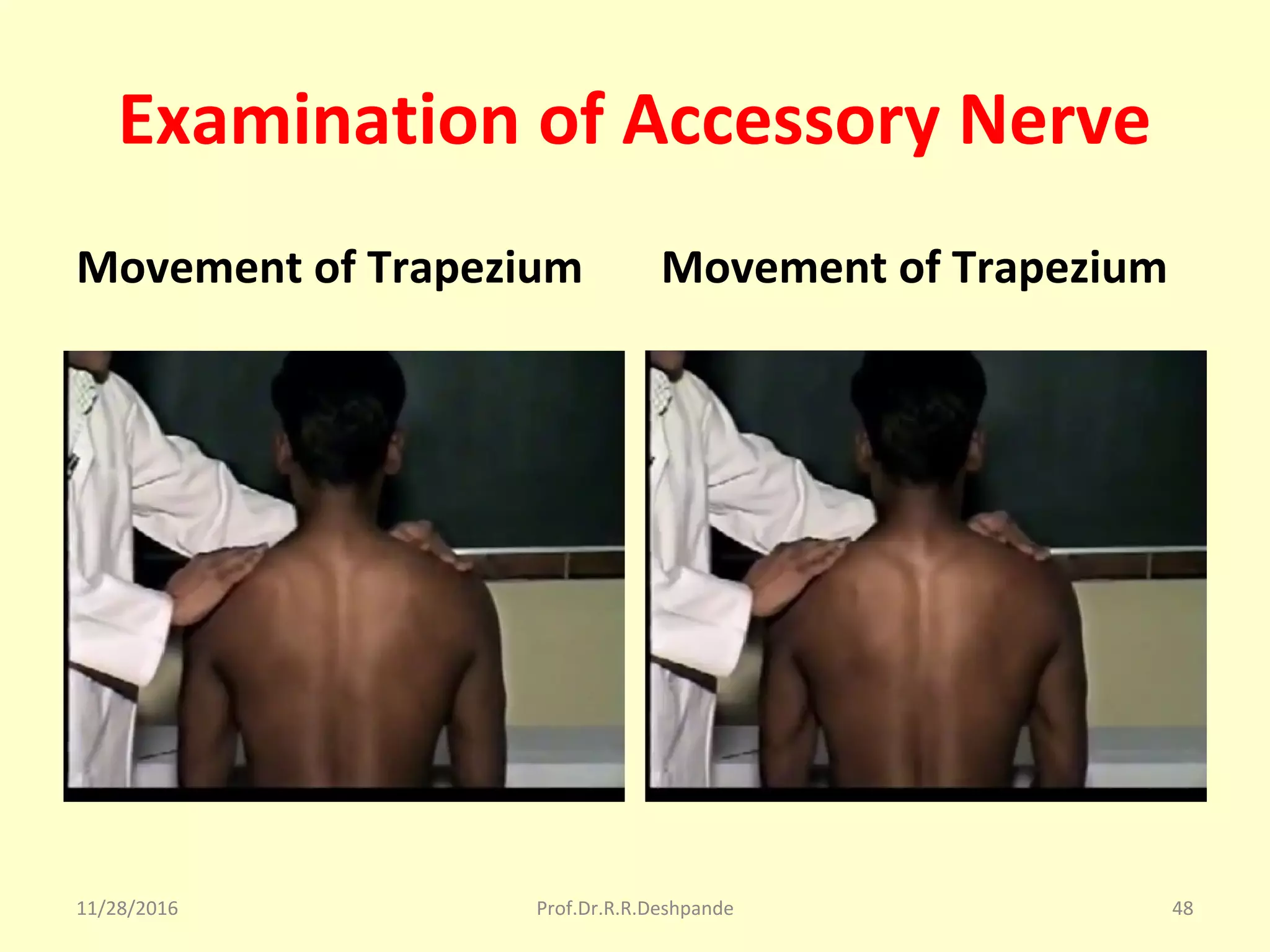 Examination of Accessory Nerve
Movement of Trapezium Movement of Trapezium
11/28/2016 Prof.Dr.R.R.Deshpande 48
 