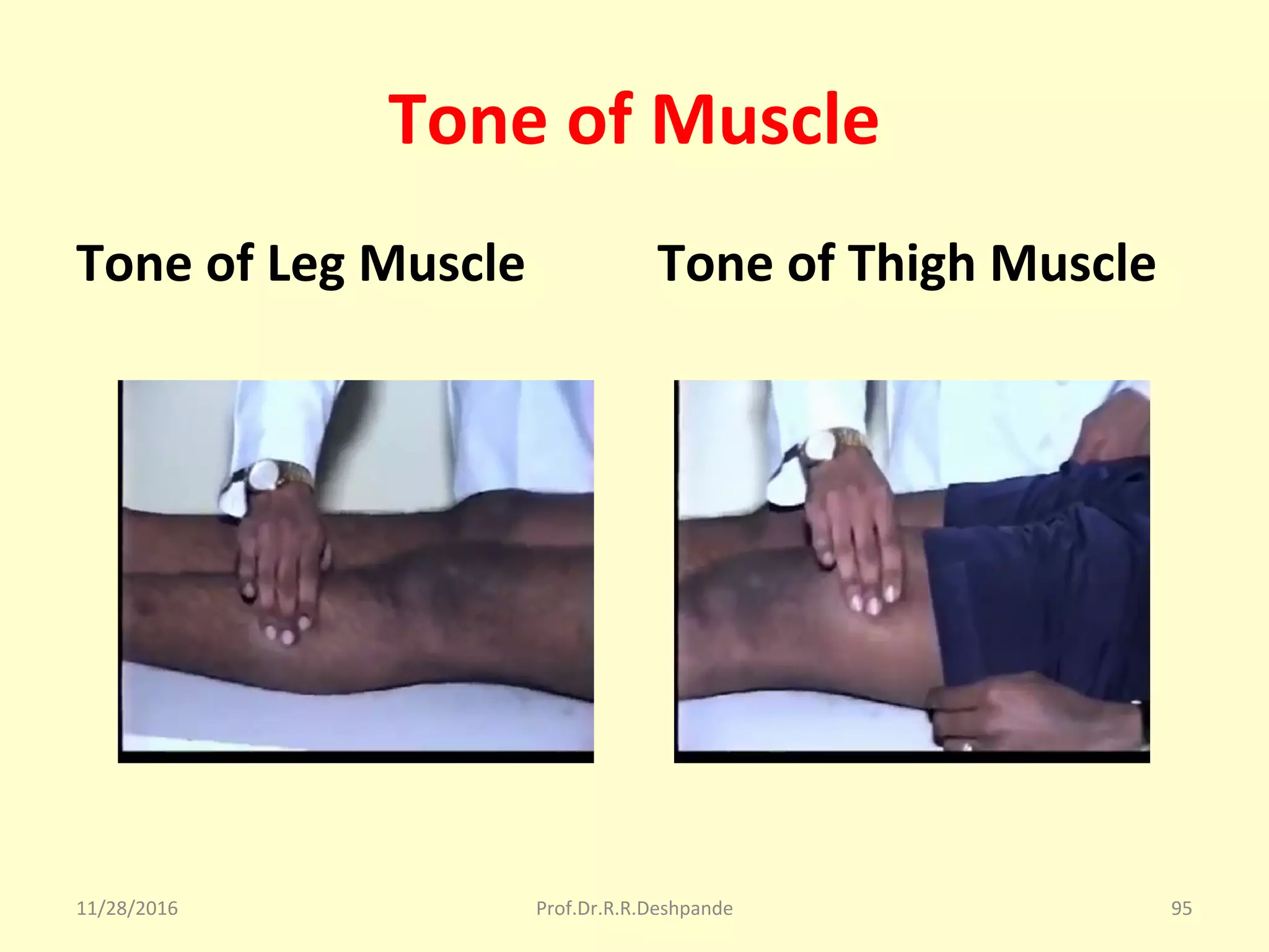 Tone of Muscle
Tone of Leg Muscle Tone of Thigh Muscle
11/28/2016 Prof.Dr.R.R.Deshpande 95
 