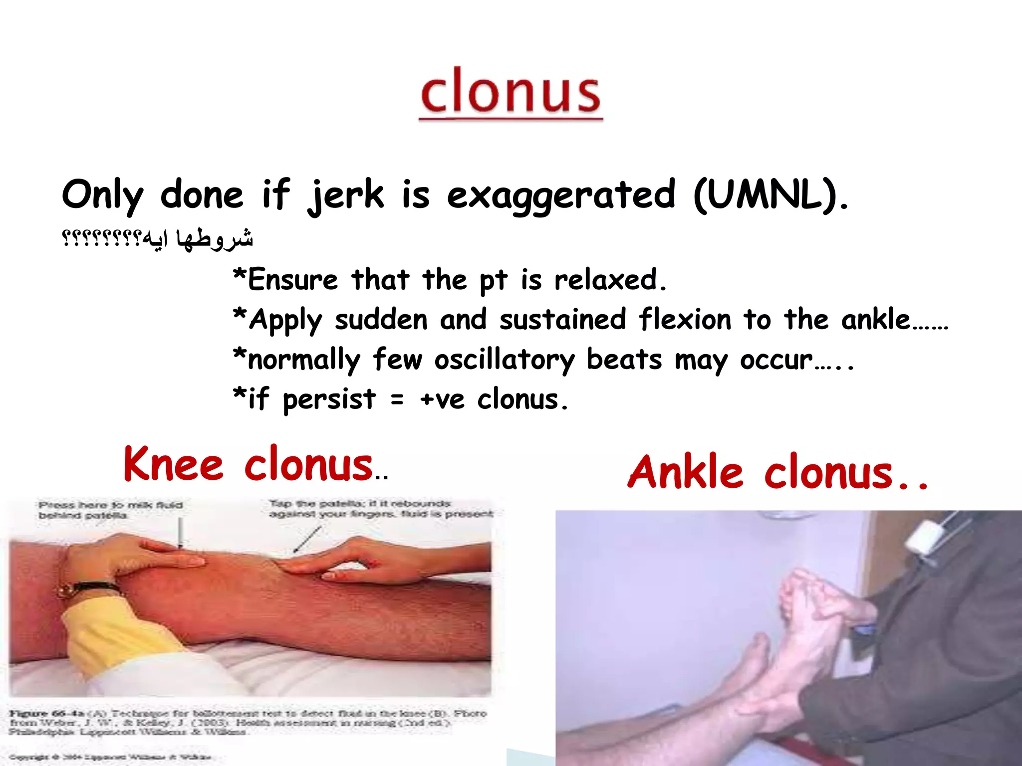 Left Clonus CNS examination | PPTX