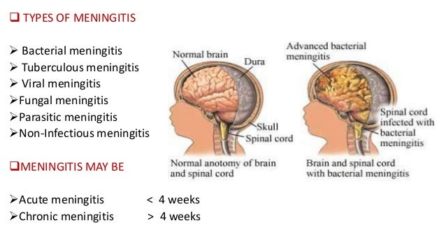 CNS INFECTION