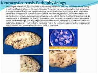 In meningeal cysticercosis, cysticerci often do not develop into typical cysts, and become racemose, lacking a scolex and becoming lobes in thin-walled bladders. These cysts increase and slowly leak their antigen into the subarachnoid CSF producing meningitis and can further develop into arachnoiditis, which may lead to obstructive hydrocephalus, cranial nerve involvement, intracranial hypertension, arterial thrombosis and stroke. In intraventricular cysticercosis, the cysts occur in the lateral, third or fourth ventricles which may be asymptomatic or if they block the flow of CSF, they may cause increased intracranial pressure. Because the larvae are relatively large, they may lodge in the subarachnoid space, ventricles, or brain tissue. Cysts in the subarachnoid space may result in chronic meningitis, cysts in the ventricular system may lead to obstruction hydrocephalus, and cysts in the cerebrum may mimic brain tumors.  Neurocysticercosis-Pathophysiology 