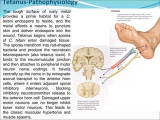 Tetanus-Pathophysiology  The rough surface of rusty metal provides a prime habitat for a  C. tetani  endospore to reside, and the metal affords a means to puncture skin and deliver endospore into the wound. Tetanus begins when spores of  C. tetani  enter damaged tissue. The spores transform into rod-shaped bacteria and produce the neurotoxin tetanospasmin (aka tetanus toxin). It binds to the neuromuscular junction and then attaches to peripheral motor neuron nerve endings. It travels centrally up the nerve in by retrograde axonal transport to the anterior horn cells, where it enters adjacent spinal inhibitory interneurons, blocking inhibitory neurotransmitter release to the anterior horn cell. Damaged upper motor neurons can no longer inhibit lower motor neurons. This leads to the classic muscular hypertonia and muscle spasms. 