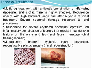 Leprosy-Treatment Multidrug treatment with antibiotic combination of  rifampin, dapsone, and clofazimine  is highly effective. Recurrence occurs with high bacterial loads and after 5 years of initial treatment. Severe neuronal damage responds to oral prednisone. Thalidomide for severe erythema nodosum leprosum (an inflammatory complication of leprosy that results in painful skin lesions on the arms and legs and face)  (teratogen-child bearing women). Management- improve hygiene, injury prevention, reconstructive plastic surgery (nasal reconstruction)  Necrotic erythema nodosum leprosum 