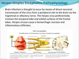 Herpes Simplex Encephalitis-Pathophysiology Brain infection is thought to occur by means of direct neuronal transmission of the virus from a peripheral site to the brain via the trigeminal or olfactory nerve. The herpes virus preferentially involves the temporal lobe and orbital surfaces of the frontal lobes. Herpes viruses cause a hemorrhagic necrosis and inflammatory infiltrates.  