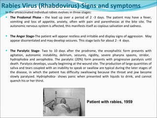 In the unvaccinated individual rabies evolves in three stages: The Prodomal Phase -  the lead up over a period of 2 -3 days. The patient may have a fever, vomiting and loss of appetite, anxiety, often with pain and parenthesias at the bite site. The autonomic nervous system is affected, this manifests itself as copious salivation and sadness. The Anger Stage- The patient will appear restless and irritable and display signs of aggression.  May appear disorientated and may develop seizures. This stage lasts for about 2 - 4  days. The Paralytic Stage-  Two to 10 days after the prodrome, the encephalitic form presents with agitation, autonomic instability, delirium, seizures, rigidity, severe pharynx spasms, stridor,  hydrophobia and aerophobia. The paralytic (20%) form presents with progressive paralysis until death. Paralysis develops, usually beginning at the wound site. The production of large quantities of saliva and tears coupled with an inability to speak or swallow are typical during the later stages of the disease, in which the patient has difficulty swallowing because the throat and jaw become slowly paralyzed. Hydrophobia -  shows panic when presented with liquids to drink, and cannot quench his or her thirst. Rabies Virus (Rhabdovirus)-Signs and symptoms Patient with rabies, 1959 