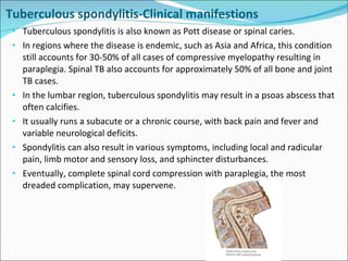 Tuberculous spondylitis-Clinical manifestions Tuberculous spondylitis is also known as Pott disease or spinal caries. In regions where the disease is endemic, such as Asia and Africa, this condition still accounts for 30-50% of all cases of compressive myelopathy resulting in paraplegia. Spinal TB also accounts for approximately 50% of all bone and joint TB cases. In the lumbar region, tuberculous spondylitis may result in a psoas abscess that often calcifies. It usually runs a subacute or a chronic course, with back pain and fever and variable neurological deficits. Spondylitis can also result in various symptoms, including local and radicular pain, limb motor and sensory loss, and sphincter disturbances. Eventually, complete spinal cord compression with paraplegia, the most dreaded complication, may supervene. 