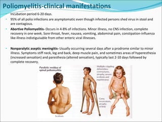 Cns infections Lecture Slide 59
