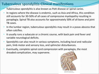 Cns infections Lecture Slide 79