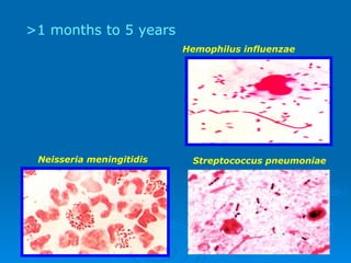 Hemophilus influenzae Neisseria meningitidis Streptococcus pneumoniae >1 months to 5 years  