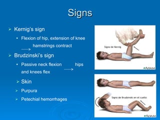 Signs Kernig’s sign Flexion of hip, extension of knee    hamstrings contract Brudzinski’s sign Passive neck flexion  hips and knees flex Skin Purpura Petechial hemorrhages 