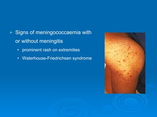 Signs of meningococcaemia with or without meningitis prominent rash on extremities Waterhouse-Friedrichsen syndrome 