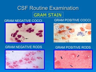 CSF Routine Examination GRAM NEGATIVE COCCI GRAM POSITIVE COCCI GRAM NEGATIVE RODS GRAM POSITIVE RODS GRAM STAIN 