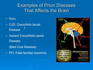 Examples of Prion Diseases That Affects the Brain Kuru CJD: Creutzfeld-Jacob Disease  Variant Creutzfield-Jacob Disease (Mad Cow Disease) FFI: Fatal familial Insomnia  􀂄 