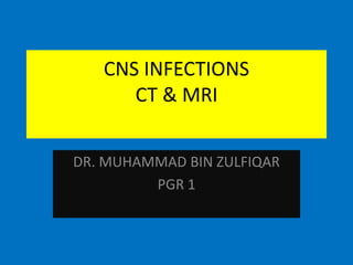 CNS INFECTIONS
CT & MRI
DR. MUHAMMAD BIN ZULFIQAR
PGR 1

 