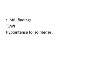 • MRI findings.
T1WI
Hypointense to isointense .
 
