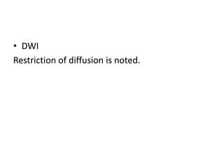 • DWI
Restriction of diffusion is noted.
 