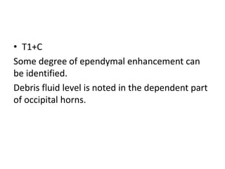 • T1+C
Some degree of ependymal enhancement can
be identified.
Debris fluid level is noted in the dependent part
of occipital horns.
 