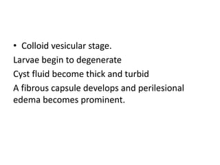 • Colloid vesicular stage.
Larvae begin to degenerate
Cyst fluid become thick and turbid
A fibrous capsule develops and perilesional
edema becomes prominent.
 