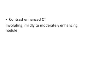 • Contrast enhanced CT
Involuting, mildly to moderately enhancing
nodule
 