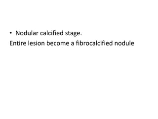 • Nodular calcified stage.
Entire lesion become a fibrocalcified nodule
 