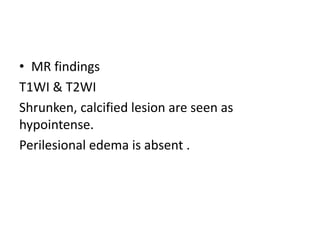 • MR findings
T1WI & T2WI
Shrunken, calcified lesion are seen as
hypointense.
Perilesional edema is absent .
 