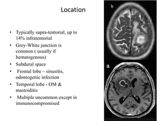 Location
• Typically supra-tentorial, up to
14% infratentorial
• Grey-White junction is
common ( usually if
hematogenous)
• Subdural space
• Frontal lobe – sinusitis,
odontogenic infection
• Temporal lobe - OM &
mastoiditis
• Multiple uncommon except in
immunocompromised
 