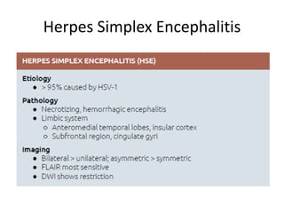 Herpes Simplex Encephalitis
 