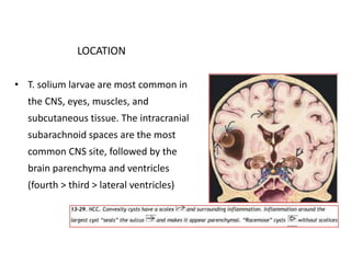 LOCATION
• T. solium larvae are most common in
the CNS, eyes, muscles, and
subcutaneous tissue. The intracranial
subarachnoid spaces are the most
common CNS site, followed by the
brain parenchyma and ventricles
(fourth > third > lateral ventricles)
 