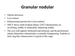 Granular nodular
• Odema decreases
• Cyst retracts
• Enhancement persists but is less marked
• NECT shows mild residual edema. CECT demonstrates an
involuting, mildly to moderately enhancing nodule.
• The cyst wall appears thickened and retracted, and the perilesional
edema diminishes substantially, eventually disappearing. Nodular or
faint ring-like enhancement is typical at this stage
 