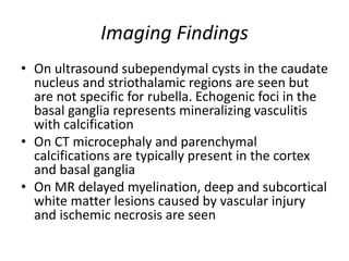 Imaging Findings
• On ultrasound subependymal cysts in the caudate
nucleus and striothalamic regions are seen but
are not specific for rubella. Echogenic foci in the
basal ganglia represents mineralizing vasculitis
with calcification
• On CT microcephaly and parenchymal
calcifications are typically present in the cortex
and basal ganglia
• On MR delayed myelination, deep and subcortical
white matter lesions caused by vascular injury
and ischemic necrosis are seen
 