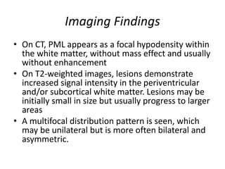 Imaging Findings
• On CT, PML appears as a focal hypodensity within
the white matter, without mass effect and usually
without enhancement
• On T2-weighted images, lesions demonstrate
increased signal intensity in the periventricular
and/or subcortical white matter. Lesions may be
initially small in size but usually progress to larger
areas
• A multifocal distribution pattern is seen, which
may be unilateral but is more often bilateral and
asymmetric.
 