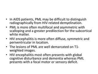 • In AIDS patients, PML may be difficult to distinguish
radiographically from HIV-related demyelination.
• PML is more often multifocal and asymmetric with
scalloping and a greater predilection for the subcortical
white matter.
• HIV encephalitis is more often diffuse, symmetric and
periventricular in location.
• The lesions of PML are well demarcated on T1-
weighted images.
• HIV encephalitis most often presents with global
cognitive disturbance and dementia whereas PML
presents with a focal motor or sensory deficit.
 