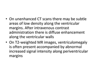 • On unenhanced CT scans there may be subtle
areas of low density along the ventricular
margins. After intravenous contrast
administration there is diffuse enhancement
along the ventricular walls
• On T2-weighted MR images, ventriculomegaly
is often present accompanied by abnormal
increased signal intensity along periventricular
margins
 
