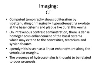 Imaging:
CT
• Computed tomography shows obliteration by
isoattenuating or marginally hyperattenuating exudate
at the basal cisterns and plaque like dural thickening
• On intravenous contrast administration, there is dense
homogeneous enhancement of the basal cisterns
which may extend to the convexities, tentorium and
sylvian fissures
• ependymitis is seen as a linear enhancement along the
ventricular margins.
• The presence of hydrocephalus is thought to be related
to poor prognosis.
 