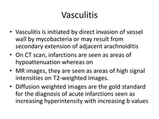 Vasculitis
• Vasculitis is initiated by direct invasion of vessel
wall by mycobacteria or may result from
secondary extension of adjacent arachnoiditis
• On CT scan, infarctions are seen as areas of
hypoattenuation whereas on
• MR images, they are seen as areas of high signal
intensities on T2-weighted images.
• Diffusion weighted images are the gold standard
for the diagnosis of acute infarctions seen as
increasing hyperintensity with increasing b values
 
