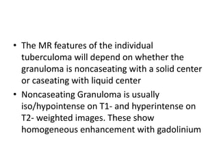 • The MR features of the individual
tuberculoma will depend on whether the
granuloma is noncaseating with a solid center
or caseating with liquid center
• Noncaseating Granuloma is usually
iso/hypointense on T1- and hyperintense on
T2- weighted images. These show
homogeneous enhancement with gadolinium
 